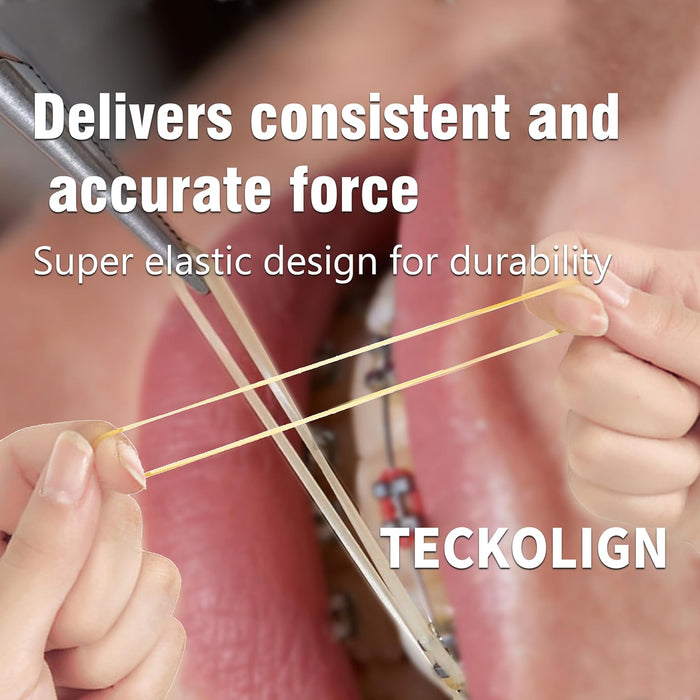 Bandas elásticas de ortodoncia, (medianas, 3.5 onzas), bandas elásticas de ortodoncia - Quierox - Tienda Online