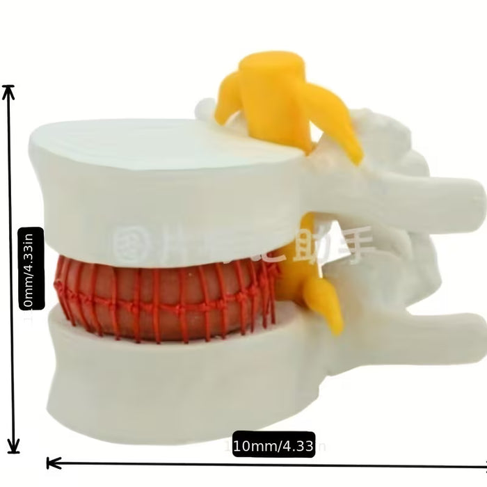 1pc Modelo De Hernia De Disco Intervertebral De Demostración Simulador Vertebral Columna