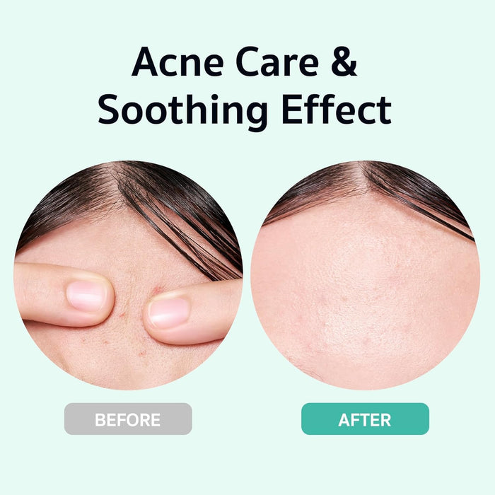 BRING GREEN X NETFLIX SQUID GAME Edition Zinc Teca Serum 0.8 fl oz | Suero calmante - Quierox - Tienda Online