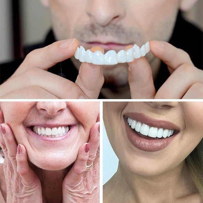 Carillas instantáneas Snap - On Perfect Smile para dientes superiores e inferiores - Quierox - Tienda Online