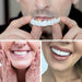Carillas instantáneas Snap - On Perfect Smile para dientes superiores e inferiores - Quierox - Tienda Online