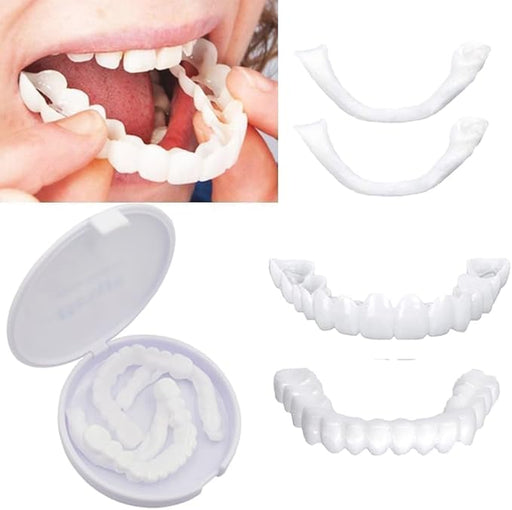 Carillas instantáneas Snap - On Perfect Smile para dientes superiores e inferiores - Quierox - Tienda Online