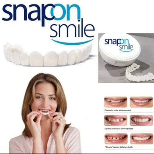 Carillas Snap - On Smile Instant Perfect Smile, cómodas prótesis flexibles para dientes superiores e inferiores - Quierox - Tienda Online