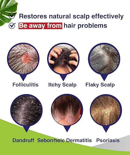 Champú antifúngico para foliculitis, dermatitis seborreica - Quierox - Tienda Online