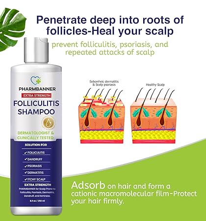 Champú antifúngico para foliculitis, dermatitis seborreica - Quierox - Tienda Online