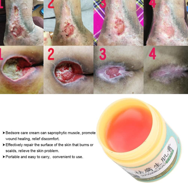 Crema casera a base de hierbas para úlceras por presión en cama, quemaduras y costras en la piel - Quierox - Tienda Online