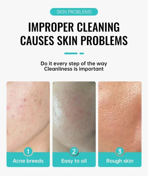 Crema con ácido salicílico para eliminar el acné. Repara el enrojecimiento y las espinillas - Quierox - Tienda Online