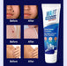 Crema para eliminar verrugas faciales (100 g) - Quierox - Tienda Online