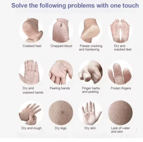 Crema para pies a base de hierbas antigrietas, reparadora de grietas en el talón, exfoliante - Quierox - Tienda Online