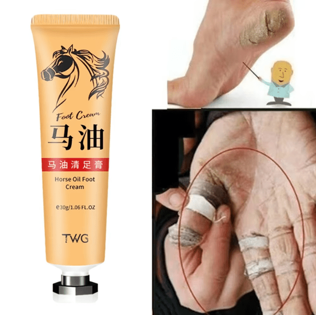 Crema reparadora de pies y manos, aceite de caballo caliente, hidratante para el cuidado de la piel del pie - Quierox - Tienda Online
