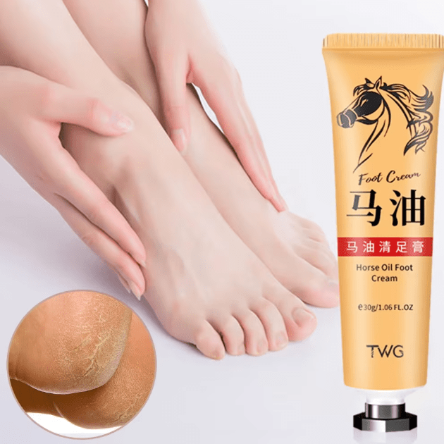 Crema reparadora de pies y manos, aceite de caballo caliente, hidratante para el cuidado de la piel del pie - Quierox - Tienda Online
