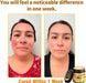 Crema todo en uno Pltowe con veneno de abeja, crema para el tratamiento de la piel - Quierox - Tienda Online