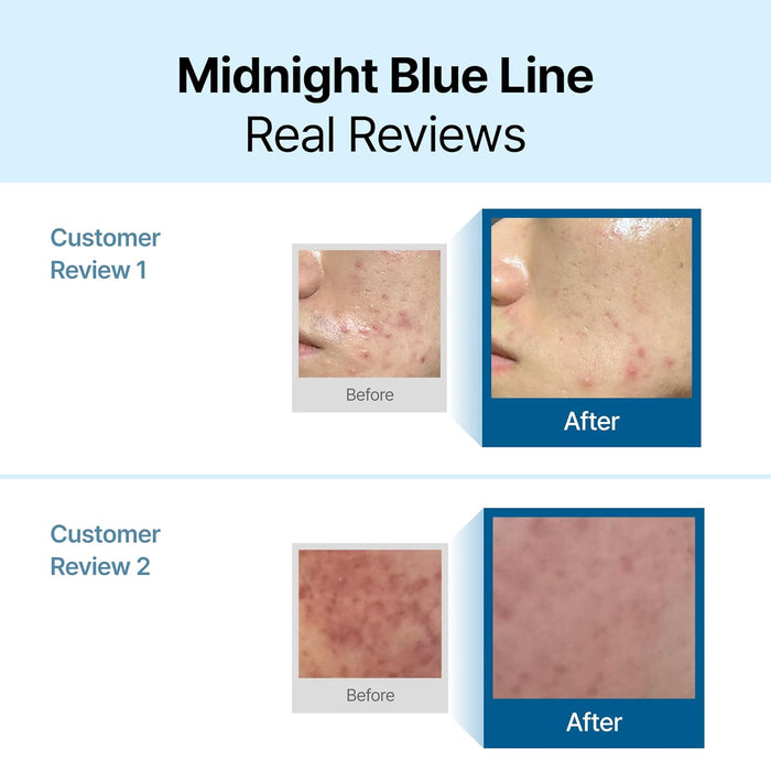 DearKlairs Crema Calmante Azul Medianoche : Hidratante facial - Quierox - Tienda Online