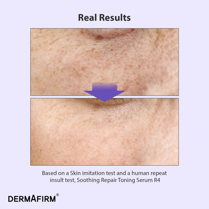 Dermafirm Suero tonificante reparador calmante R4, 30ml - Quierox - Tienda Online