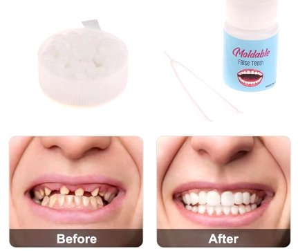 Dientes postizos y Pegamento - Quierox - Tienda Online