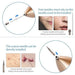 Dispositivo de belleza facial para eliminar manchas oscuras, lunares y tatuajes.. - Quierox - Tienda Online