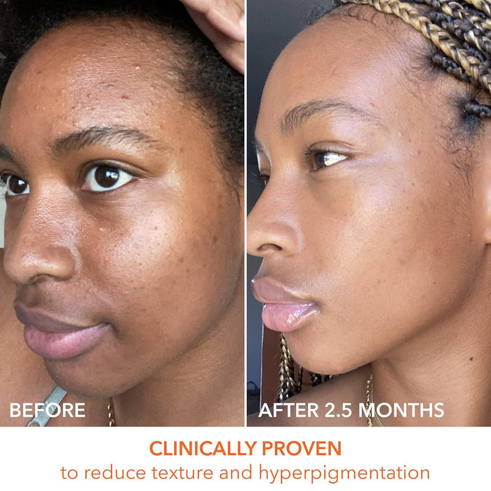 Dr. Dennis Gross Alpha Beta Universal Peel: para tono desigual - Quierox - Tienda Online