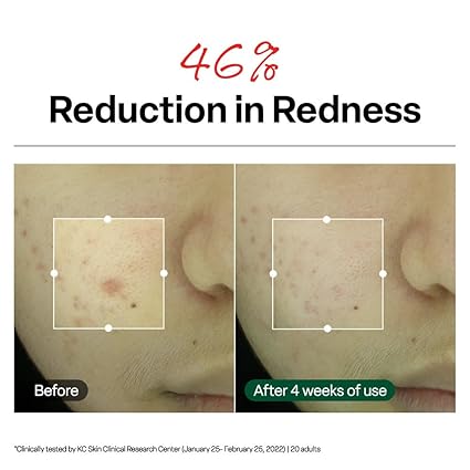 Dr. G R.E.D. Crema Calmante para Aclara las Manchas - Hidratante Coreano Tranquilizante - Quierox - Tienda Online