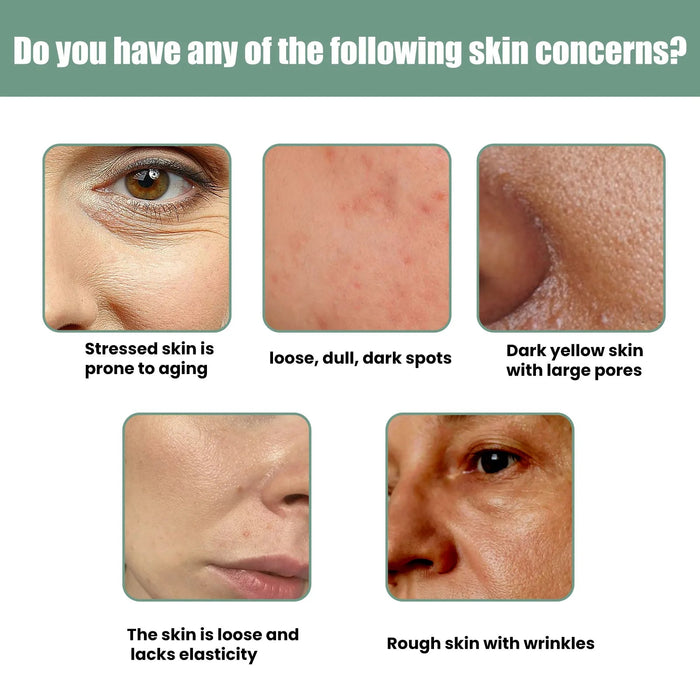 EELHOE - suero potenciador de colágeno, eliminador de arrugas 30ml - Quierox - Tienda Online