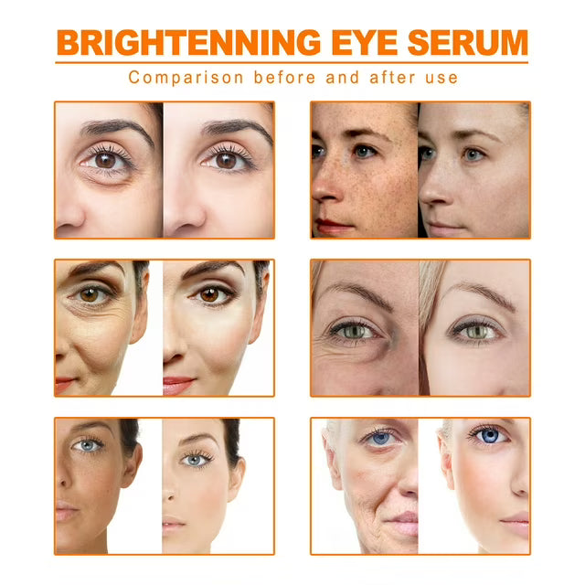 Aceite esencial de cúrcuma orgánico, 10 ml