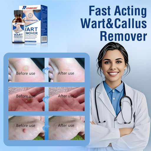 Gel líquido eliminador de verrugas de acción rápida - Quierox - Tienda Online