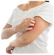 Globe (4 unidades) Ungüento transparente de hidrocortisona de máxima resistencia al 1%, 1oz - Quierox - Tienda Online