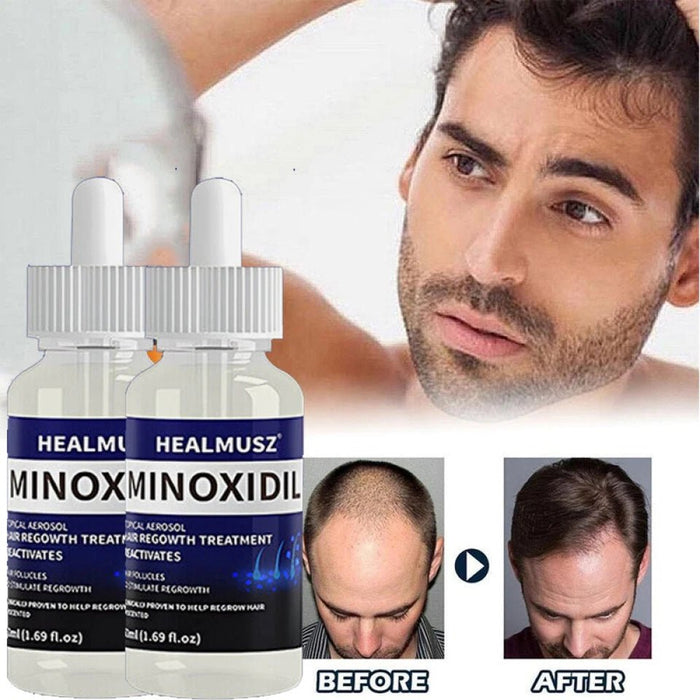 HEALMUSZ Minoxidil 5% Solución Tópica para el Crecimiento del Cabello - Quierox - Tienda Online