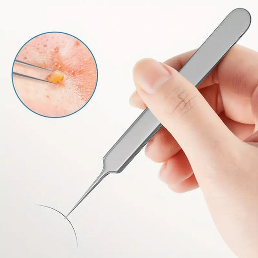 Herramienta Para Eliminar Puntos Negros, Extractor De Comedones - Quierox - Tienda Online