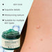 Houkea Gel para eliminar lunares y marcas en la piel. Reduce la opacidad y las imperfecciones de la piel, 50g - Quierox - Tienda Online