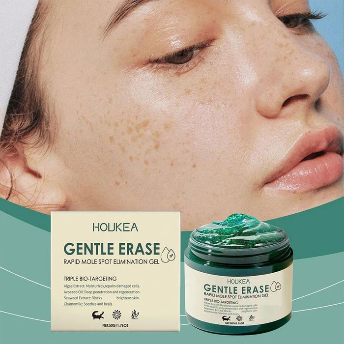 Houkea Gel para eliminar lunares y marcas en la piel. Reduce la opacidad y las imperfecciones de la piel, 50g - Quierox - Tienda Online