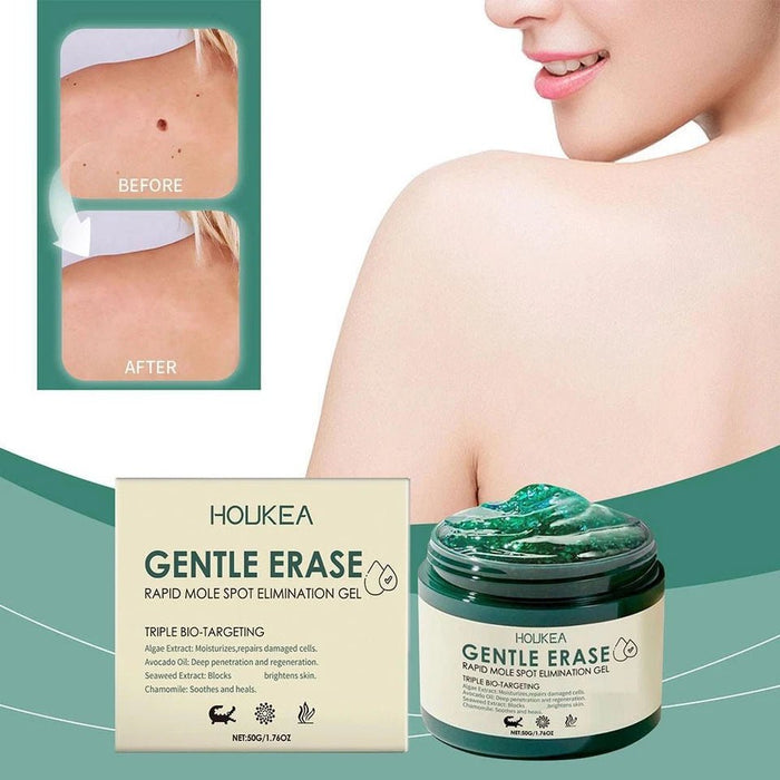 Houkea Gel para eliminar lunares y marcas en la piel. Reduce la opacidad y las imperfecciones de la piel, 50g - Quierox - Tienda Online