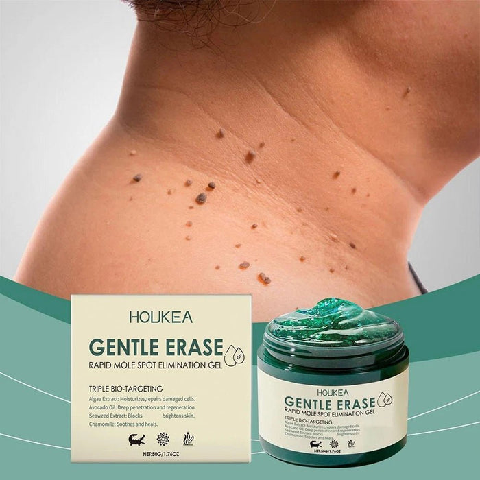 Houkea Gel para eliminar lunares y marcas en la piel. Reduce la opacidad y las imperfecciones de la piel, 50g - Quierox - Tienda Online