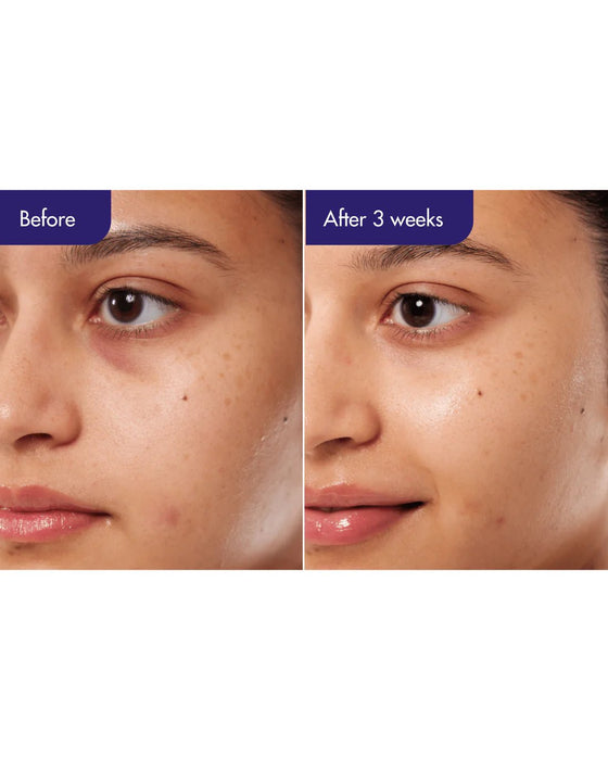 IOPE Suero de cafeína PDRN - Quierox - Tienda Online