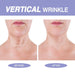 Irismistx Crema para el Cuello, Cremas para el Cuello para Tensar y Reafirmar, 50ml - Quierox - Tienda Online