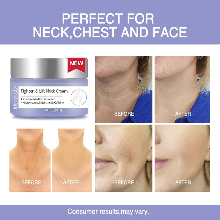 Irismistx Crema para el Cuello, Cremas para el Cuello para Tensar y Reafirmar, 50ml - Quierox - Tienda Online