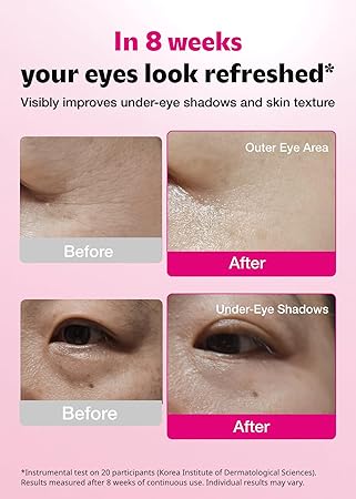 ISOI Blemish Care Parches para el contorno de ojos , hinchazón y arrugas - Quierox - Tienda Online