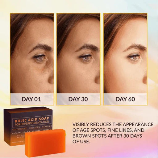 Jabón en barra para eliminar manchas oscuras con ácido kójico - Quierox - Tienda Online