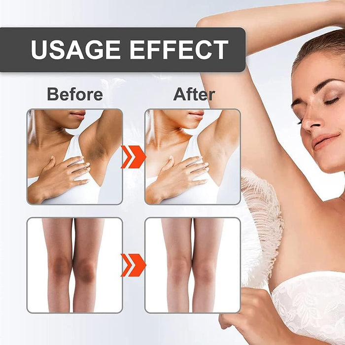 Jaysuing Snow Bleach Crema blanqueadora para rostro, axilas y áreas privadas - Quierox - Tienda Online