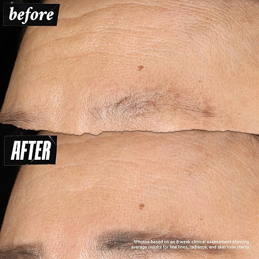 Kiehl's Crema suave súper correctiva, hidratante facial antienvejecimiento para pieles grasas - Quierox - Tienda Online