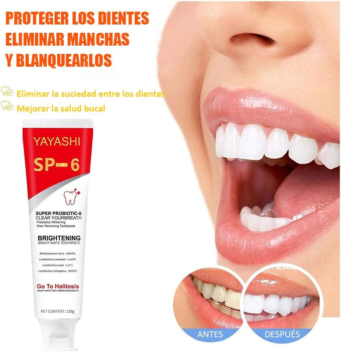 Kit de blanqueamiento dental YAYASHI SP - 6 | Paquete de 1 | Elimina manchas + protege encías - Quierox - Tienda Online