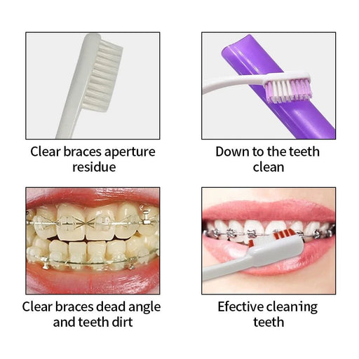 Kit de cuidado dental ortodóncico de 8 piezas - Quierox - Tienda Online