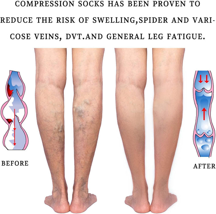 Lin Performance Calcetines de compresión médica de 20 - 30 mmHg para mujeres y hombres, hasta la rodilla - Quierox - Tienda Online