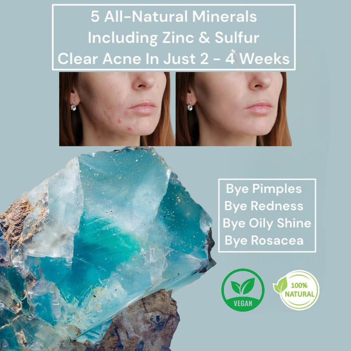 Loma Lux: Píldora para el acné minerales naturales para la limpieza de la piel - Quierox - Tienda Online