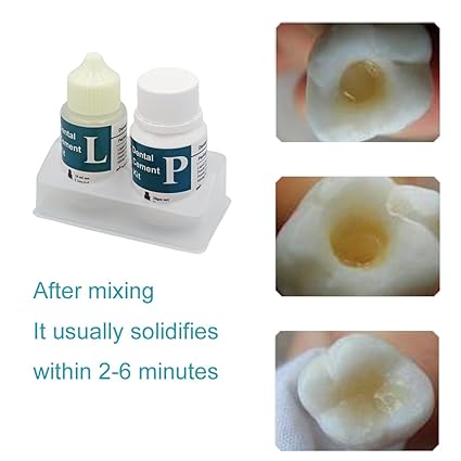 Longkason - Kit de cemento dental de óxido de zinc Eugenol | Superadhesivo - Quierox - Tienda Online