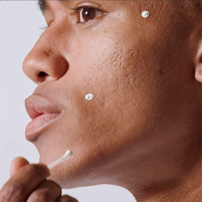 Malin + Goetz - Tratamiento para el acné nocturno, PARA manchas de acné con azufre - Quierox - Tienda Online