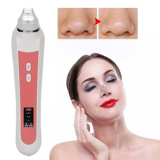 Máquina de limpieza facial máquina de eliminación de espinillas - Quierox - Tienda Online