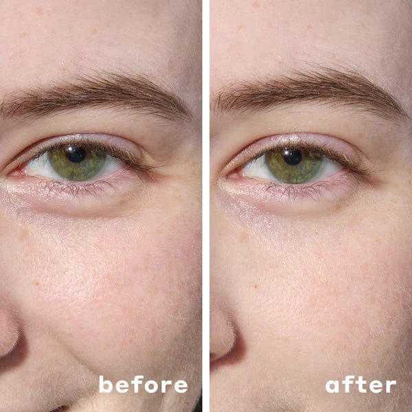Mario Badescu Parches de hidrogel para debajo de los ojos, 60 parches - Quierox - Tienda Online