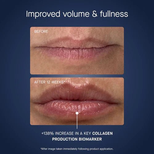 Mascarilla labial OS - 01 - Quierox - Tienda Online