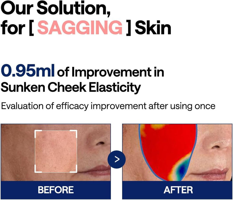 MEDIHEAL - Almohadillas tonificantes faciales cuadradas de algodón con colágeno y ceramida (100 unidades) - Quierox - Tienda Online