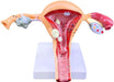 Modelo anatómico de patología de ovario de útero - Quierox - Tienda Online